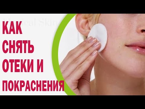 Как снять отеки и покраснения после выдавленных прыщей