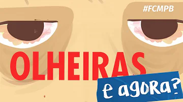 Quais são as causas das olheiras?