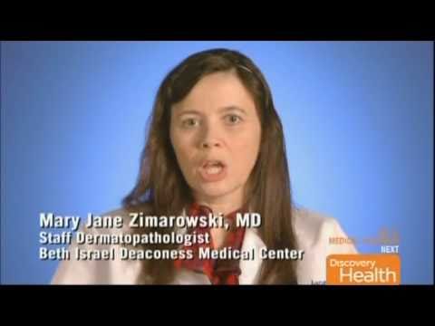 Mystery Diagnosis - Part 2 of 2 - MRH "Multicentri...