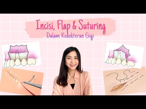 PRAKTIKUM PREKLINIK III 2020 : FLAP DAN SUTURING (Ni Made Ariyanti / 17-46)