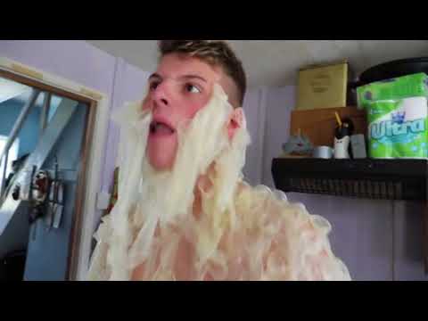 Ben Phillips Pranks - BUSTED NOSE!!! - Ben Phillips Pranks - BUSTED NOSE!!!
