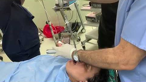 How to use the Video Stylet for intubation | Clinical Intubation Procedures for the Video Stylet