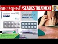 Scabies treatment      scabies medicines