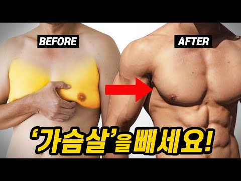 가슴지방을 제거하는 가장 효과적인 방법 4가지!? (feat. 남자 &rsquo;여유증&rsquo; 원인)