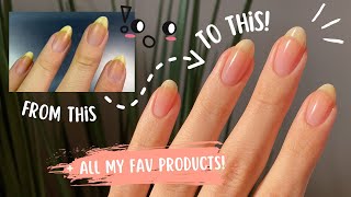 My Nail Care ESSENTIALS ✨ My Routine, Fav Base & Top Coats and Tips to Transform Your Nails 🤩💅🏼