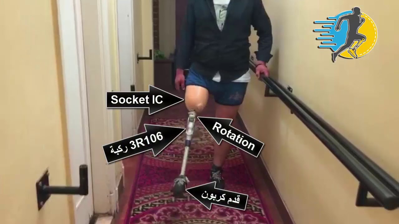 طرف صناعي الماني فوق الركبة قدم كربون وسوكت IC Rotation