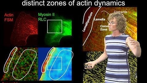 Microscopy: Quantitative Analysis of Speckle Microscopy (Clare Waterman)
