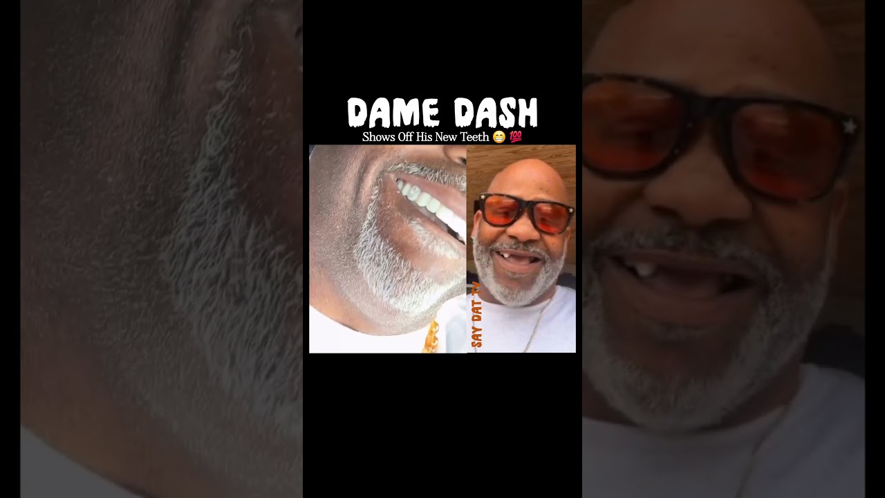 Dame Dash Flexing With His New Teeth.