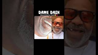 Dame Dash Flexing With His New Teeth.