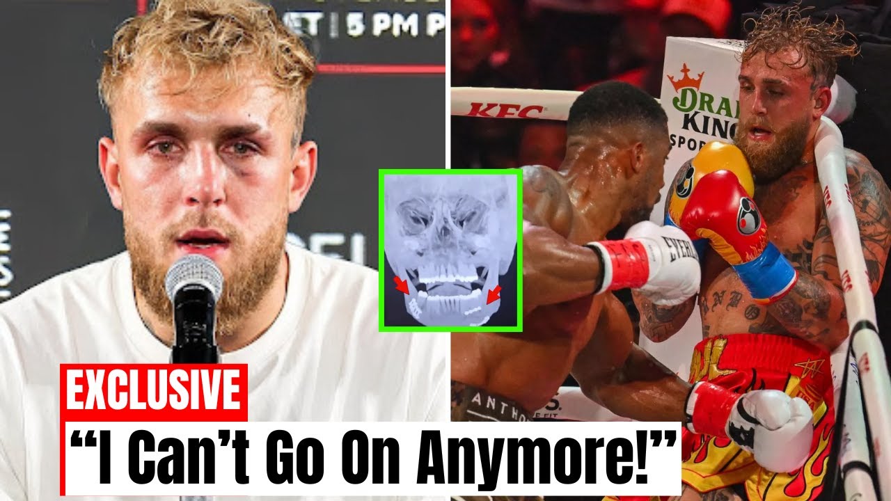 Anthony Joshua DESTROYS Jake Paul – Broken Jaw Sparks Retirement Rumors