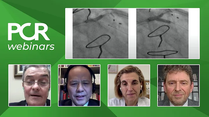 How should I select and treat a patient with DK crush technique? - Webinar