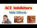 ACE Inhibitor Side Effects | Ramipril, Enalapril, Captopril, Perindopril | Causes and Why They Occur