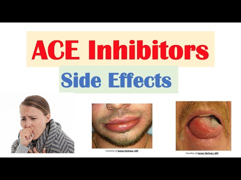 ACE Inhibitor Side Effects: Lisinopril, Ramipril, Captopril, Perindopril | Causes and Why They Occur