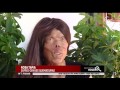 Mujer quemada lucha para reconstruir su rostro - Reportaje completo