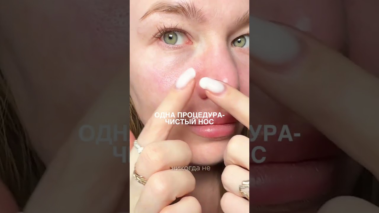 Артикул ВБ на оригиналы Аппарат 5 в 1 Mezonica 