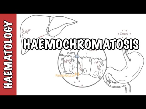 Video: Ar paveldima hemochromatozė sukelia anemiją?