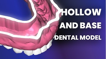 How to Hollow and Base Dental Model for 3D Printing