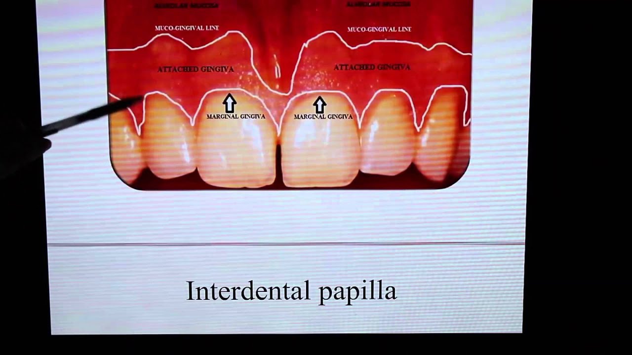 Perio Lecture For Dental Student Part 1 Youtube