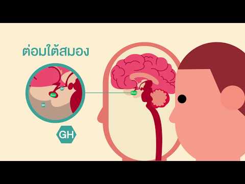 วีดีโอ: 3 วิธีในการวินิจฉัย Acromegaly