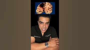 #Cocaine #Addiction #Drugs #Lifestyle #Life #Medical #Health #Wellness #MentalHealth