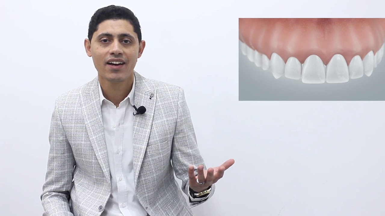 الزراعة ولا التركيبات الثابته ؟