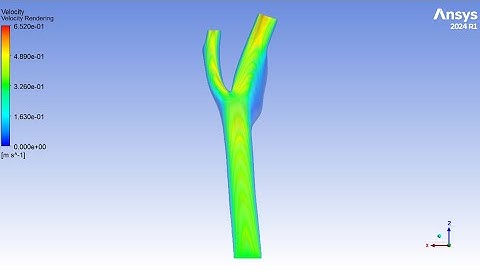 Carotid Bifurcation Artery (steady) | ANSYS Fluent