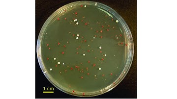 Genetics - UV Lethality and Mutation in Yeast part 1