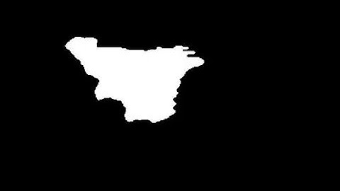 Segmentation Video of Thyroid