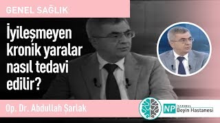 İyileşmeyen kronik yaralar nasıl tedavi edilir?