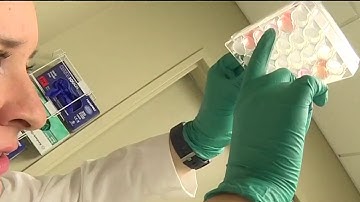 Researchers use stem cells to grow mini brains