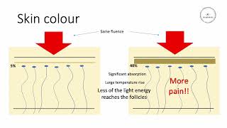 Laser/IPL Hair Removal - Choosing the correct fluence and the importance of skin colour