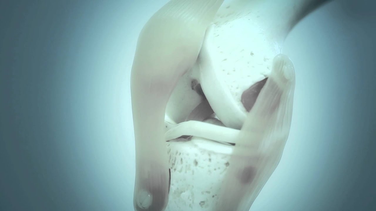 Animation Knee FlexionExtension by RPA Janssen M.D.mov YouTube