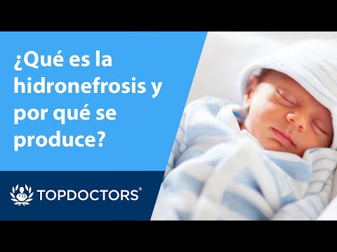 Video: ¿Es la hidronefrosis una enfermedad renal crónica?