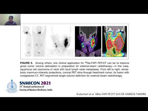 SNMICON 2021| Understanding FAPI in relevance to tumor biology| Invited talk