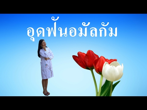 อุดฟันอมัลกัม