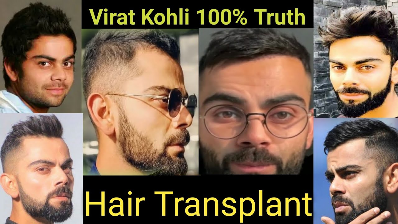 Indian Cricketers Who Seemingly Got Hair Transplant Secretly