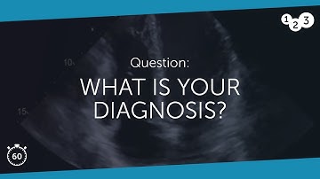 60 Seconds of Echo Teaching Question: What is your diagnosis?