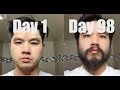 Download Lagu I Grew Out My Beard For 3 Months Using Minoxidil (Rogaine)