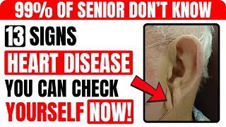 13 Visible Signs of HEART DISEASE You Can Check Yourself | Healthy Senior