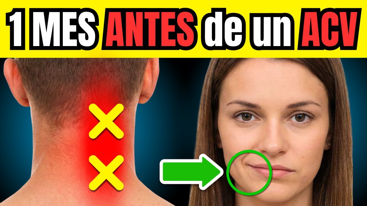 7 SEÑALES de ADVERTENCIA 1 MES ANTES DE UN ACV (ICTUS CEREBRAL) - YouTube