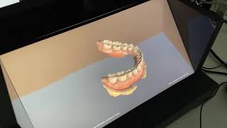 口腔内スキャナーとCBCTのデータを裸眼立体視できる空間再現ディスプレイ用アプリ The Dental Stereoscopic Content using SONY ELF-SR1