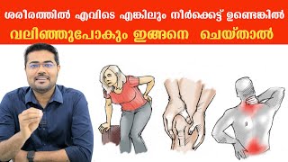 ശരീരത്തിൽ എവിടെ എങ്കിലും നീർക്കെട്ട് ഉണ്ടെങ്കിൽ വലിഞ്ഞുപോകും ഇങ്ങനെ  ചെയ്താൽ @BaijusVlogsOfficial