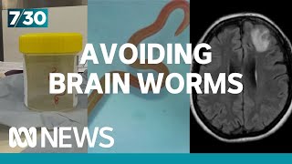 How Worried Should We Be About Brain Worms And Parasites? 7.30