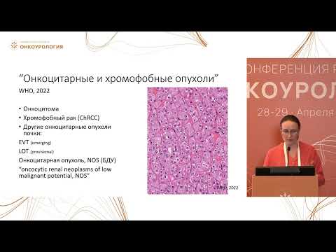 Новая патоморфологическая классификация рака почки на горизонте. Что необходимо знать онкологу?