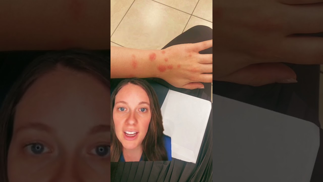 Do You Have Bed Bugs? 