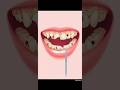#asmr Animation | Extreme Dental Cleaning 🦷😧| #satisfying #animation #shorts