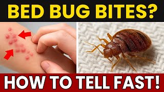 How to Identify Bed Bug Bites FAST 🔍 (Proven Signs You’re Missing!)