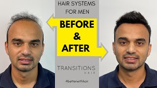 Watch This!  Before & After -  Non-Surgical Hair Systems for Men -  Sydney Australia - UK / USA screenshot 5