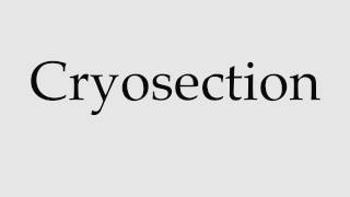 How to Pronounce Cryosection