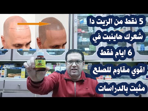 زيت خشب الصندل لسرعة انبات الشعر في مقدمة الراس وملئ الفراغات ومقاومة الصلع الوراثي/ مثبت بالدراسات